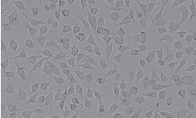 MCF-7人乳腺癌细胞