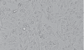 SW-1573人非小细胞肺癌细胞