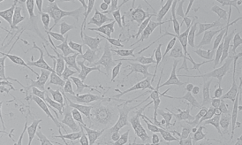 SH-SY5Y人神经母细胞瘤细胞