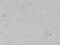 S180小鼠腹水瘤细胞