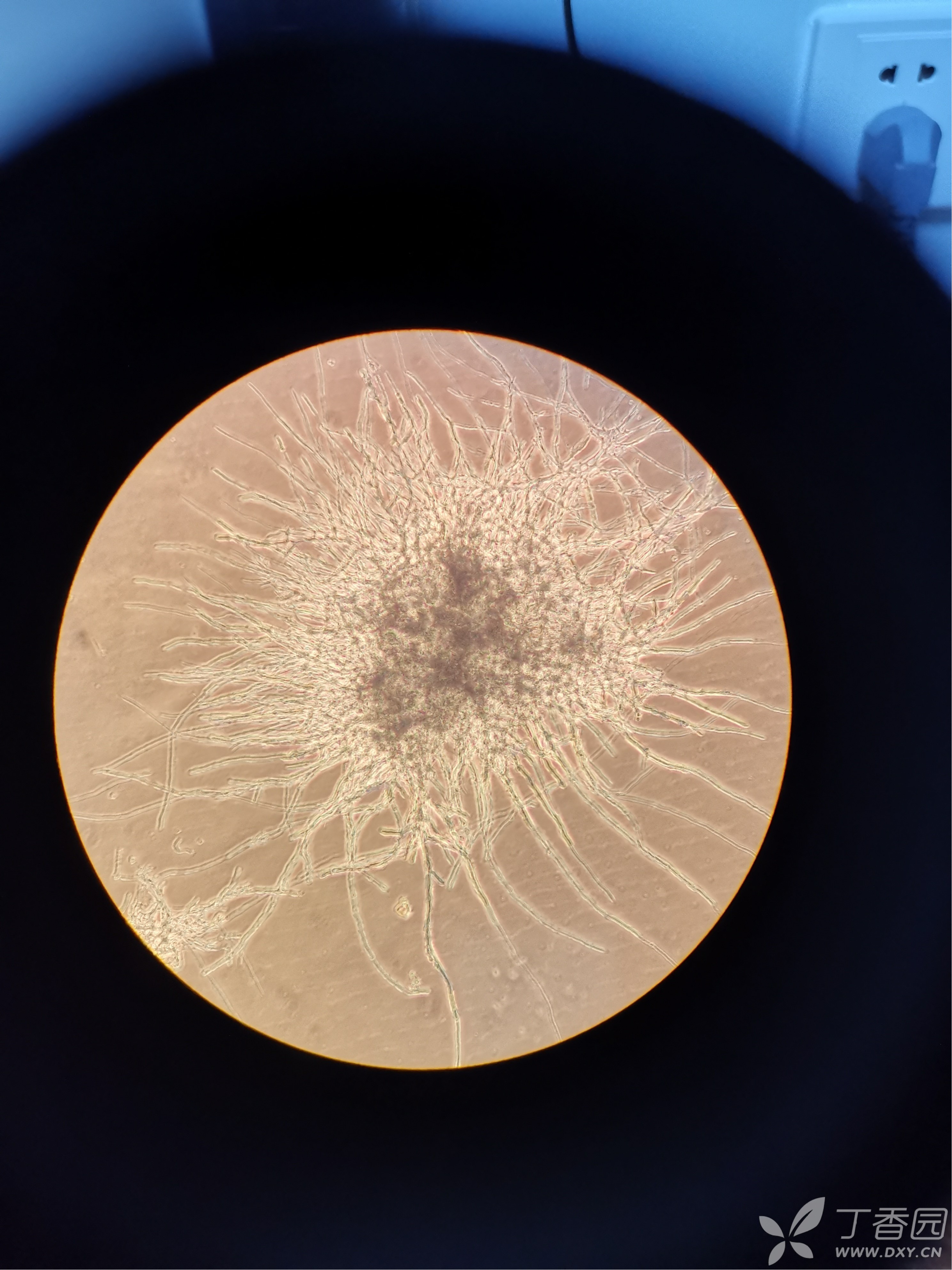 细胞培养真菌污染图片
