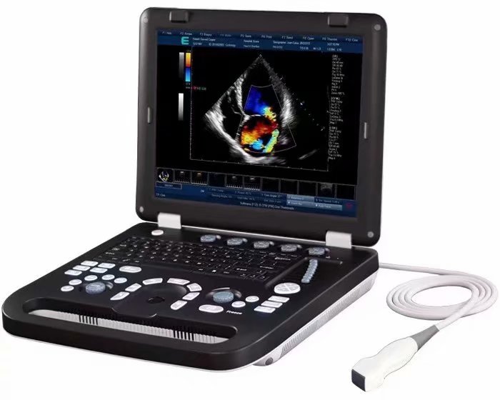 医用A8型二维彩色多普勒彩超