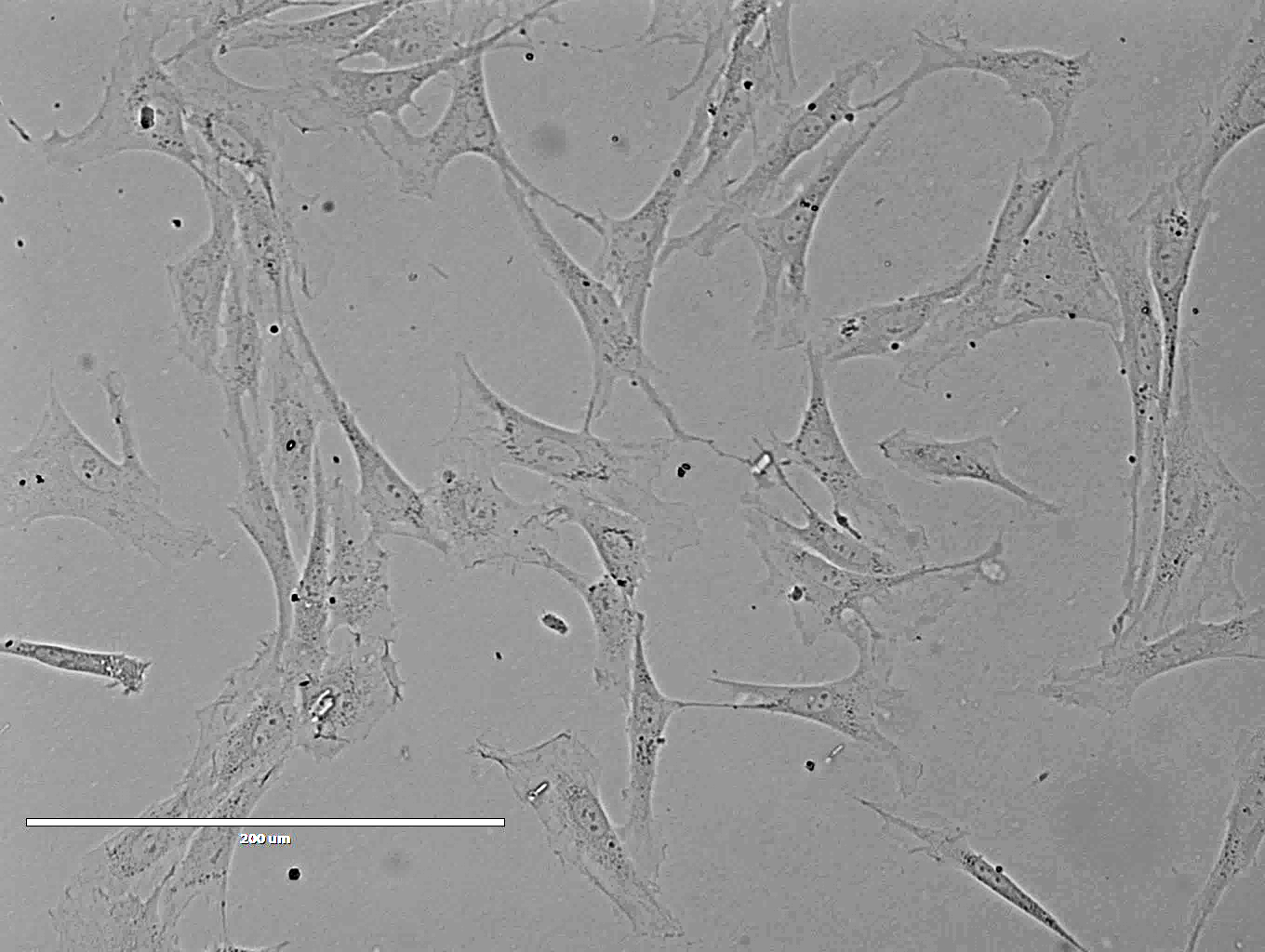 Rat Abdominal Aorta Endothelial Cells大鼠腹主动脉内皮细胞