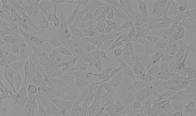 NCI-H157人非小细胞肺腺癌细胞