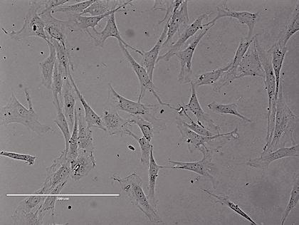 Rat Abdominal Aorta Endothelia