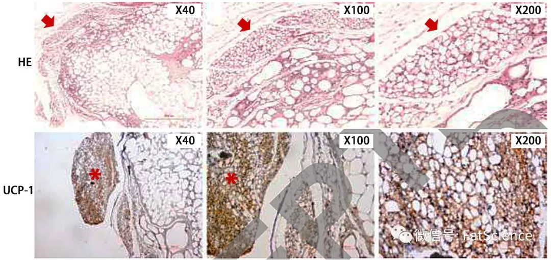 脂肪移植后的存活，“移植物”和“宿主”到底谁说了算？