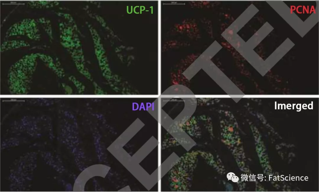 脂肪移植后的存活，“移植物”和“宿主”到底谁说了算？