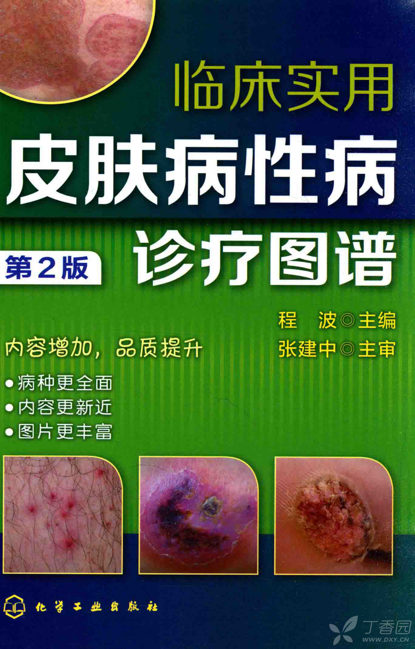 包含上海市皮肤病性病防治中心黄牛挂号联系方式的词条