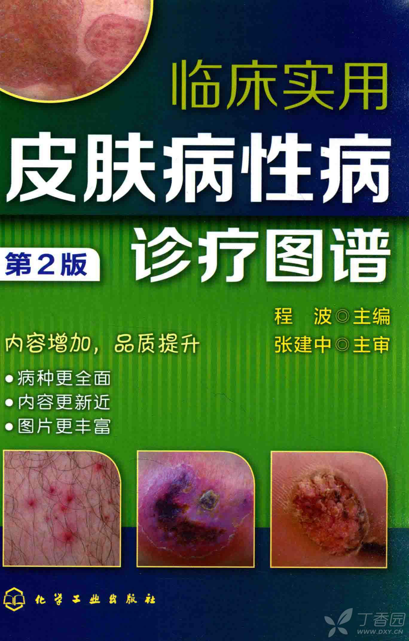 包含上海市皮肤病性病防治中心黄牛挂号合理收费的词条