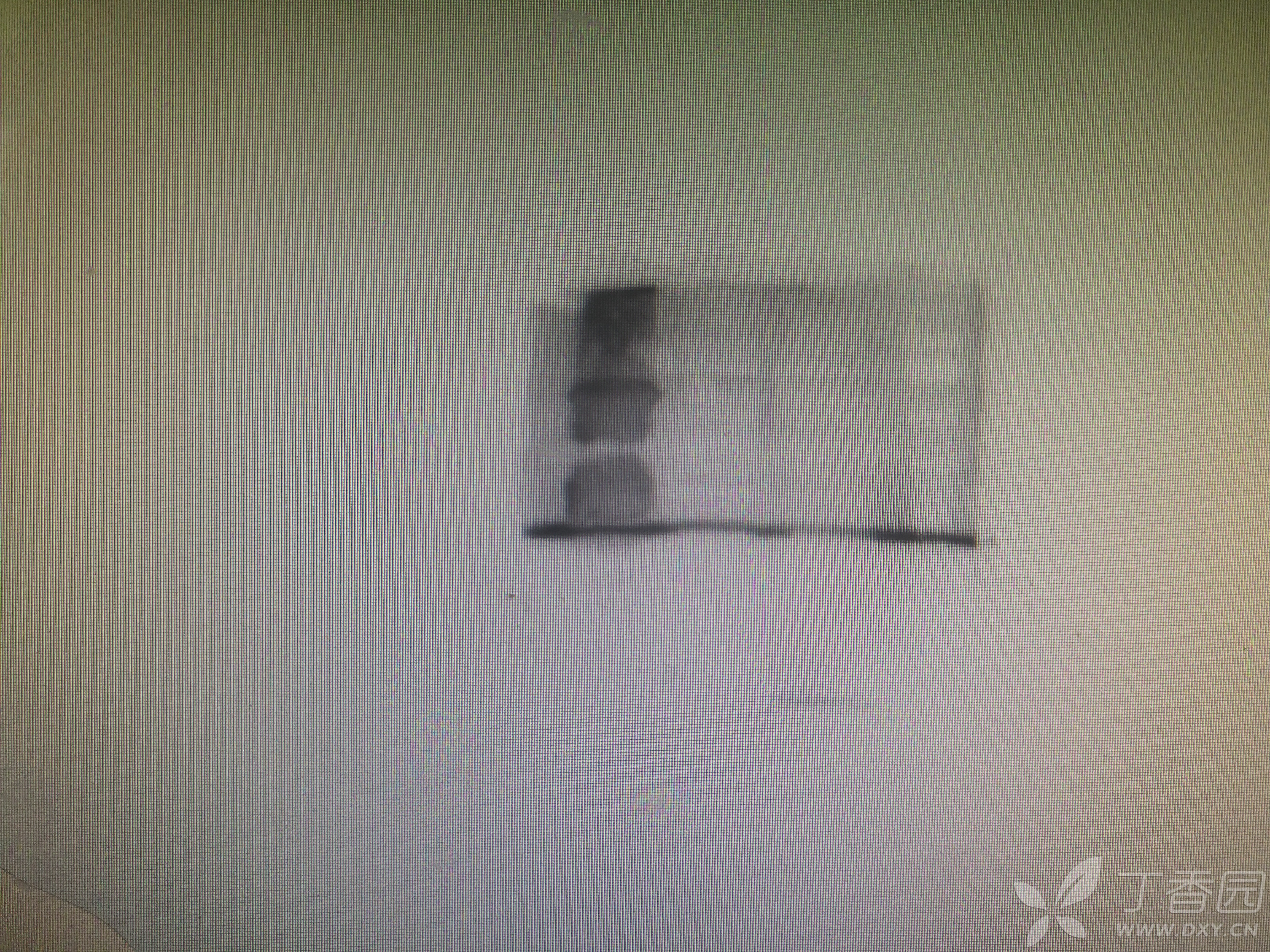 求助!跑western blot每次在35kd左右都会出现一条长的杂带贯穿全膜