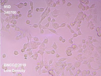 人肺巨细胞癌细胞