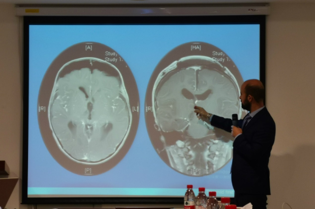 圆和再邀英专家来访、分享儿童神经外科发展成果