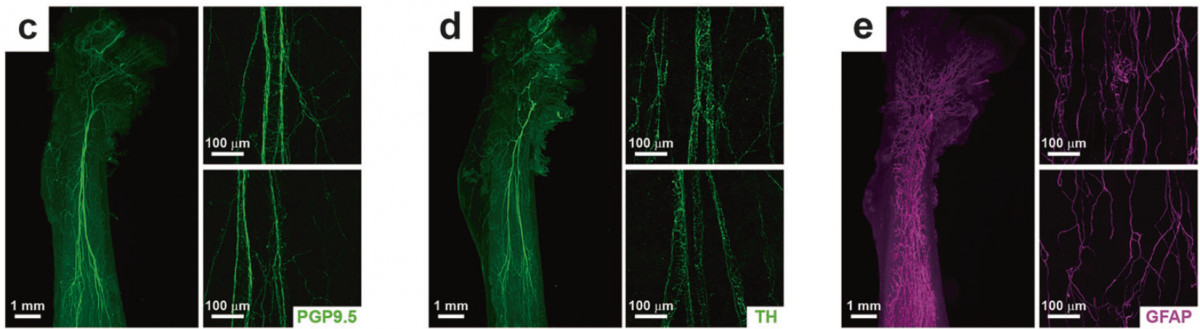光片成像小课堂开讲！中德科学家同时发表基于透明化骨新研究！