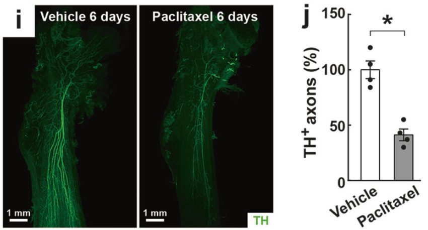 光片成像小课堂开讲！中德科学家同时发表基于透明化骨新研究！