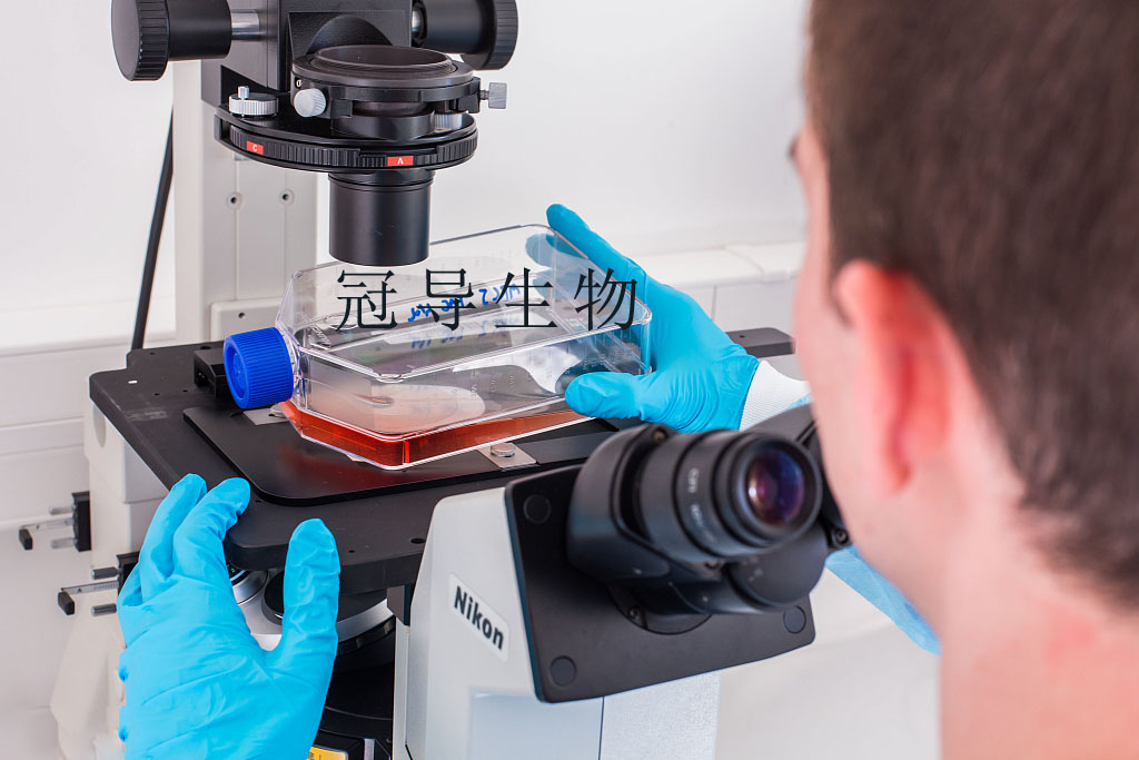 gpc-1 Cell|人前列腺癌細胞