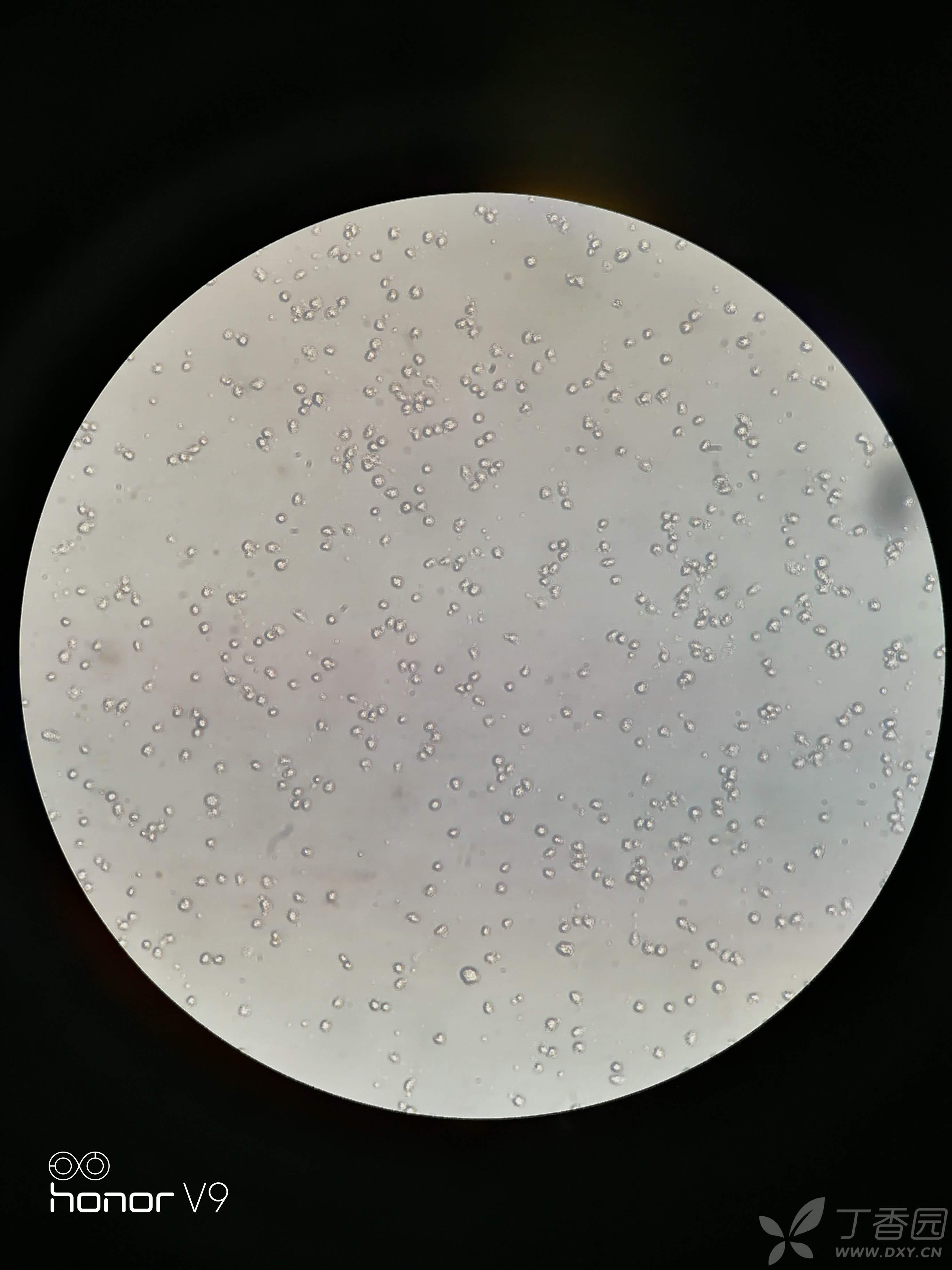 7培养求助:贴壁不牢 - 细胞技术讨论版 - 专业医生社区,医学,药学