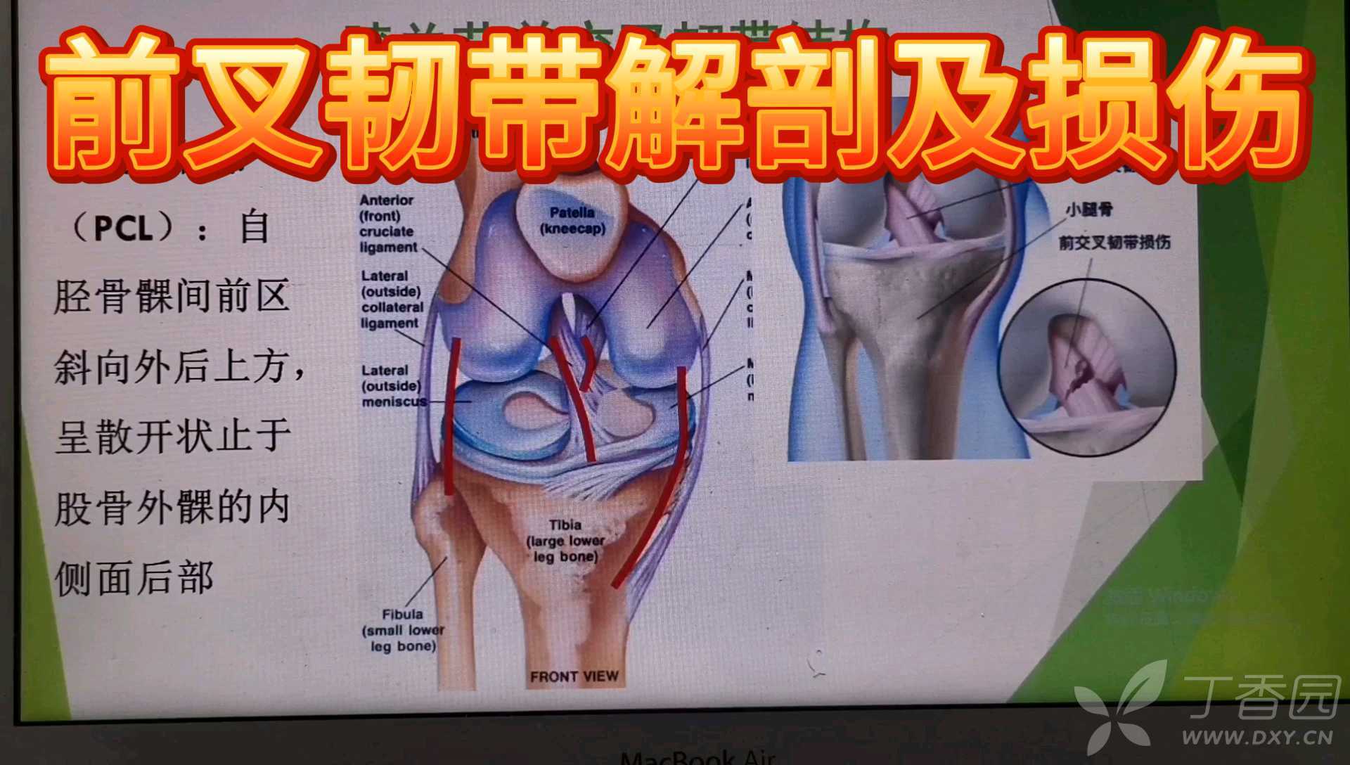 膝關節磁共振解剖及常見疾病影像學表現系列五前叉韌帶解剖及損傷