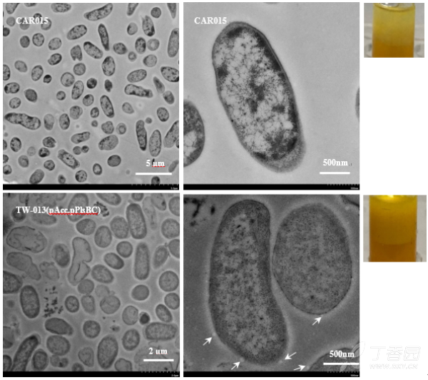 大肠杆菌透射电镜图片