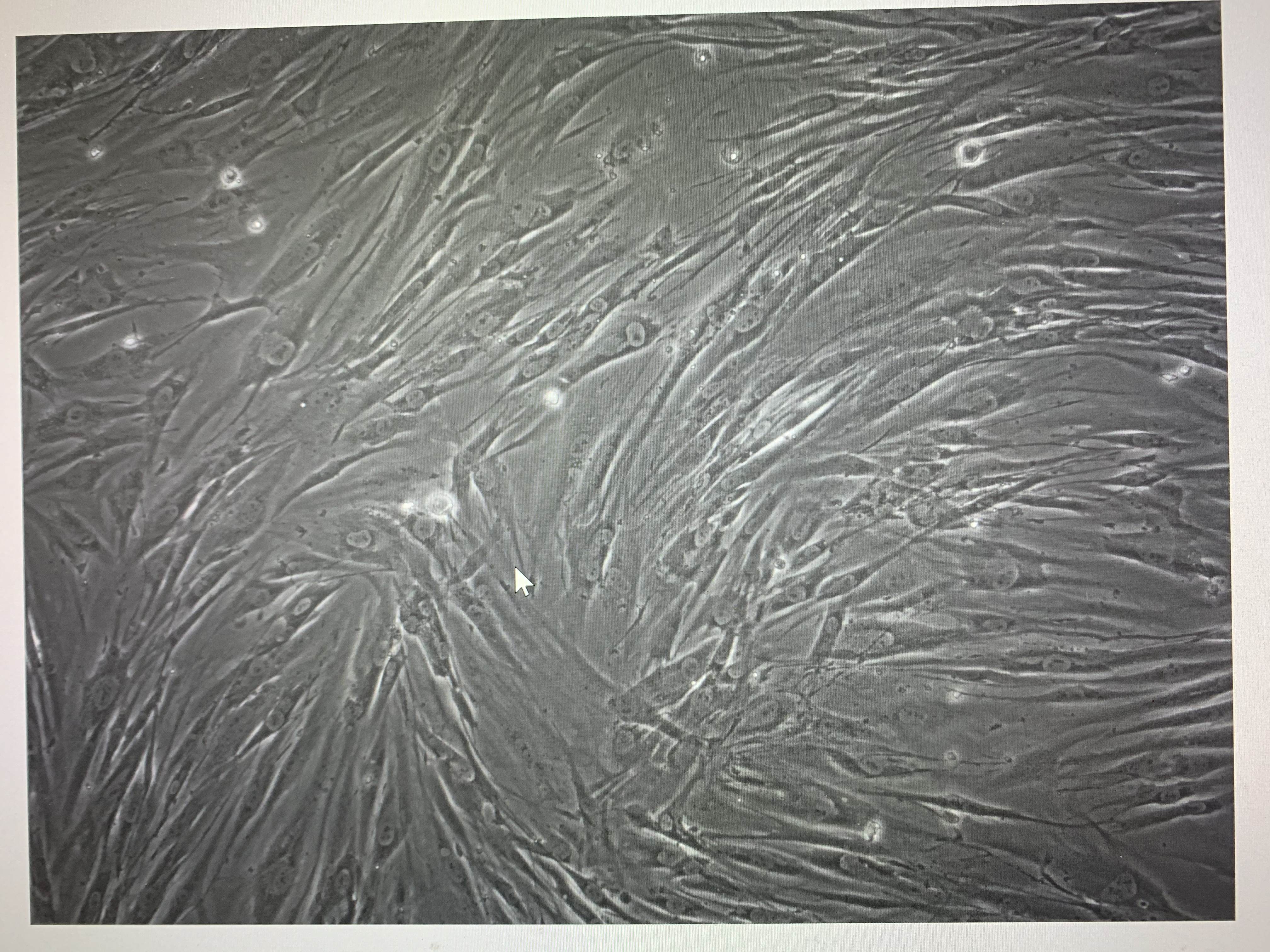 成纤维细胞显微镜图片图片