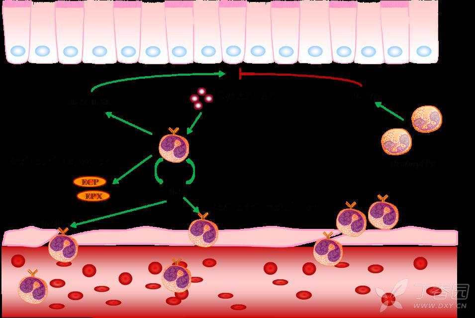 慢性鼻窦炎伴鼻息肉患者嗜酸性粒细胞活化机制