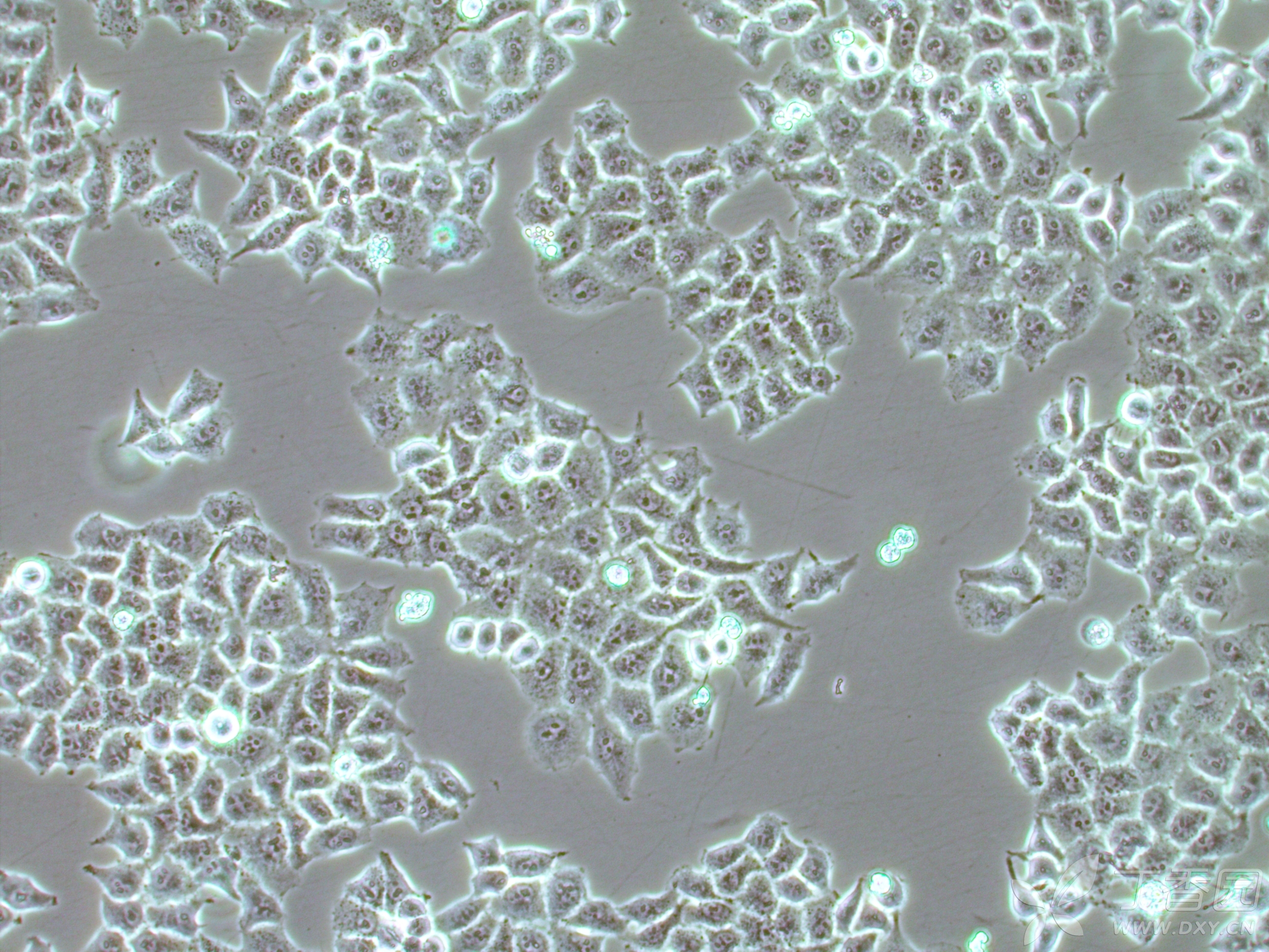 请问我养的肝癌细胞hepg2这是什么情况