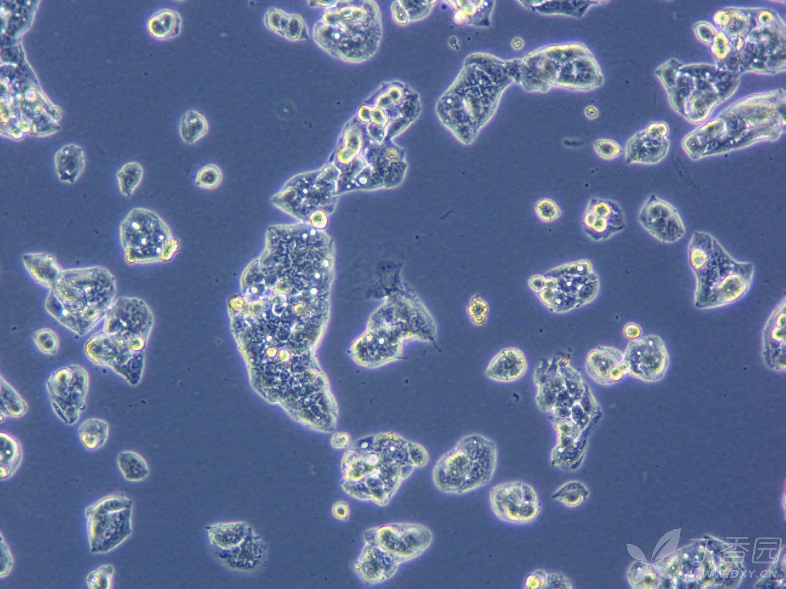 请问我养的肝癌细胞hepg2这是什么情况 - 丁香园论坛