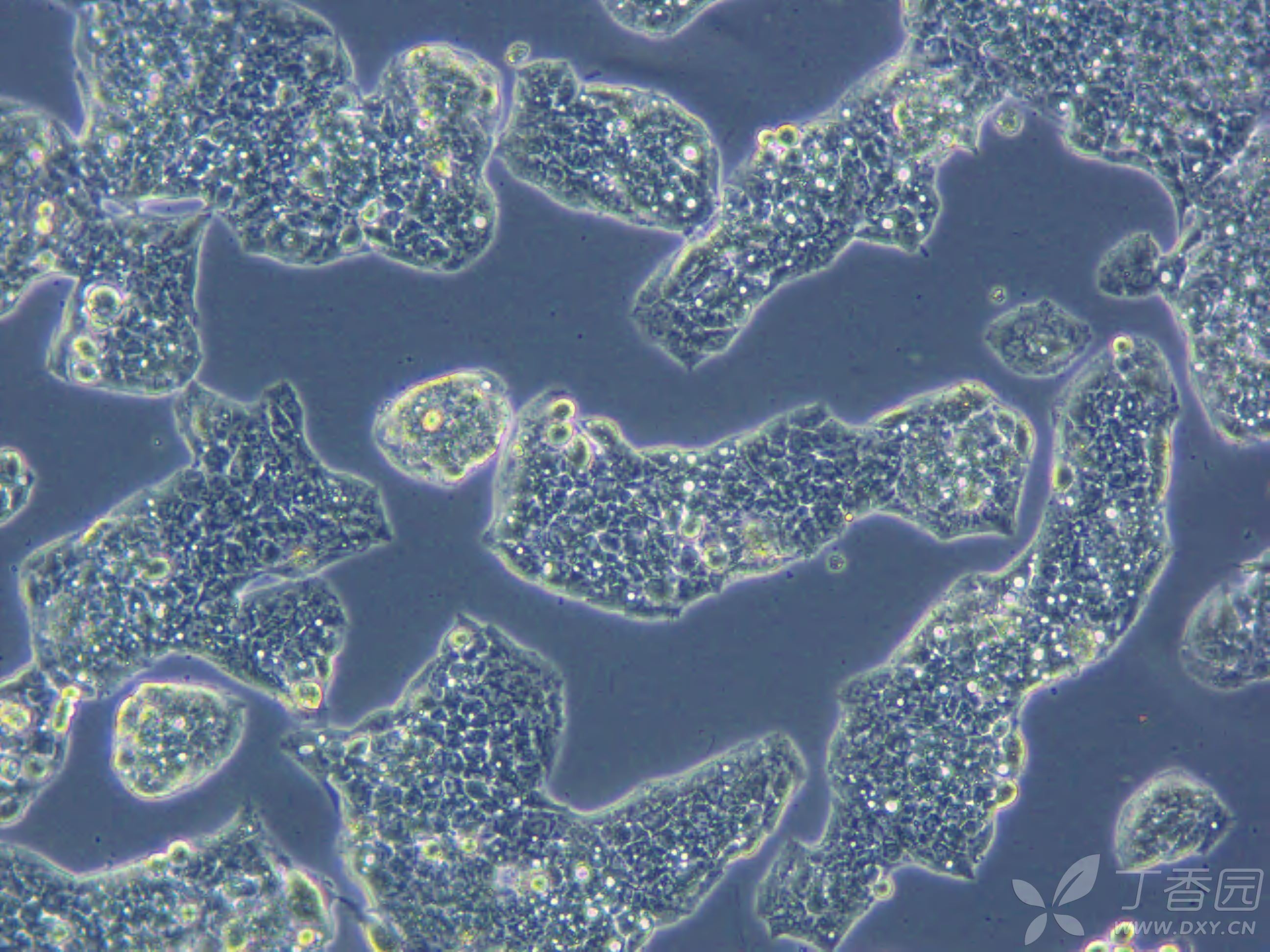 请问我养的肝癌细胞hepg2这是什么情况