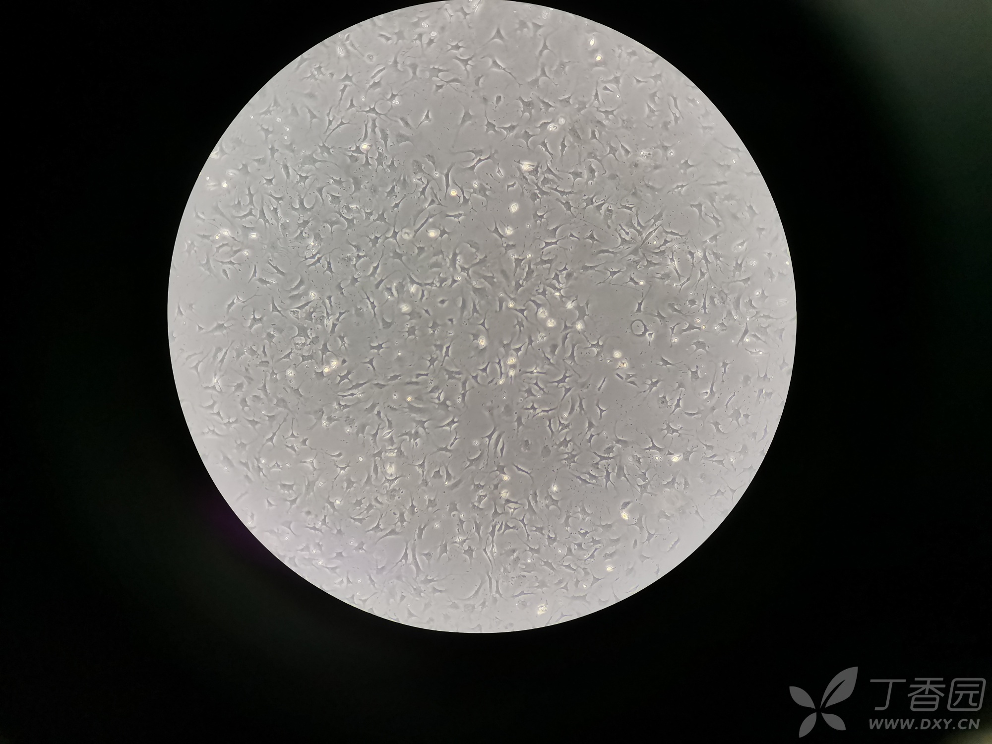 成纤维细胞显微镜图片图片