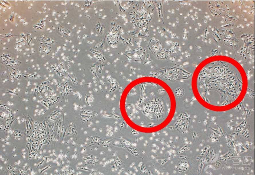 小鼠骨髓间充质干细胞培养现奇怪细胞