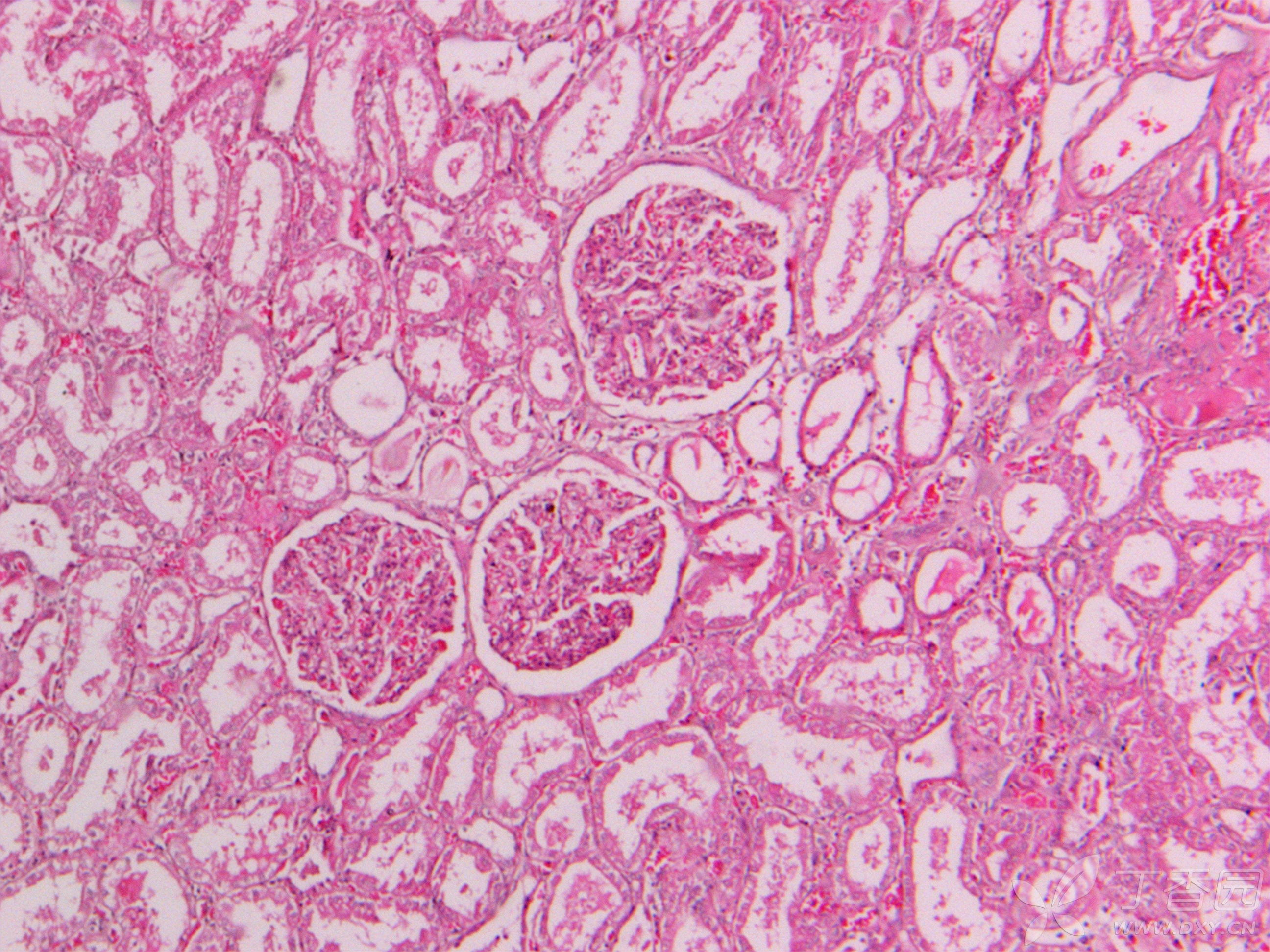 肾皮质和肾髓质切片图片