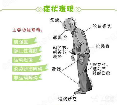 一些诸如睡眠障碍,精神异常,感觉障碍和自主神经功能障碍等非运动症状