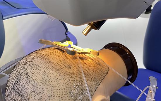 复星健康展台推植发手术辅助机器人 精确度可达50微米