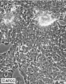 HepG2人肝癌细胞