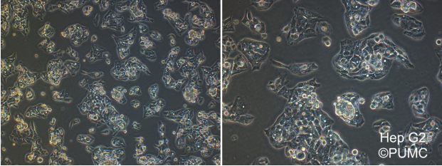 HepG2人肝癌细胞