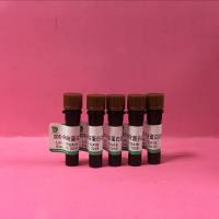 SDS-PAGE蛋白加样缓冲液(5×)