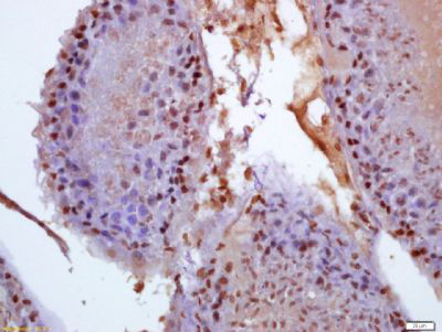 磷酸化乳腺癌抗雌激素耐药蛋白1抗体