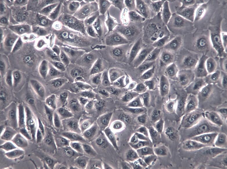 NCI-H661细胞、NCI-H661细胞、NCI-H661细胞