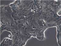 Calu-1细胞、Calu-1细胞、Calu1细胞