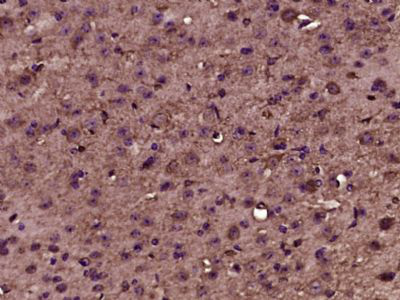 磷酸化神经Wiskott Aldrich综合征蛋白抗体