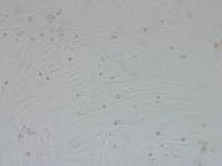 人骨髓间充质干细胞