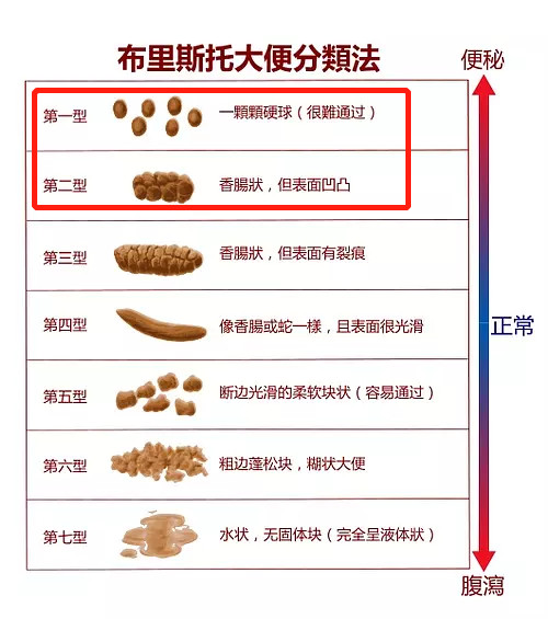 新生儿大便形状对照表图片