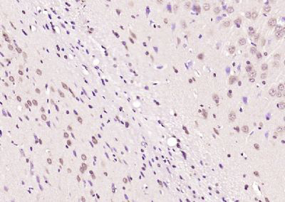膜相关鸟苷酸反转激酶1抗体