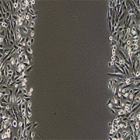 细胞划痕试验