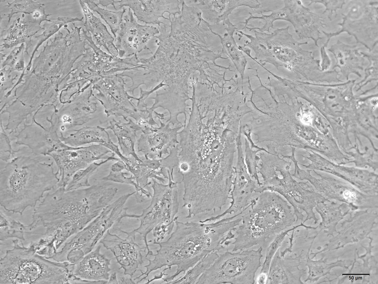 大鼠肾系膜细胞