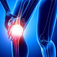 骨科类疾病模型的构建