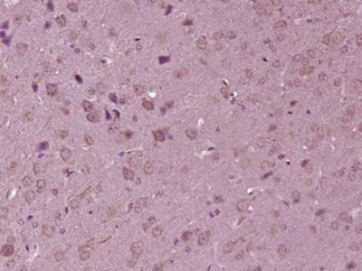 驱动蛋白家族蛋白7抗体