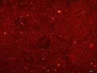 小鼠冠状微血管内皮细胞