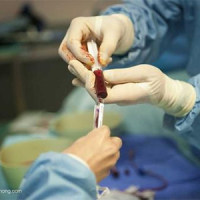 移植类模型研究