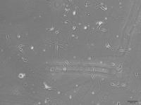 大鼠脊髓神经元