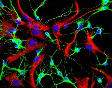 小胶质细胞介导的慢性炎症反应对机体是有害的